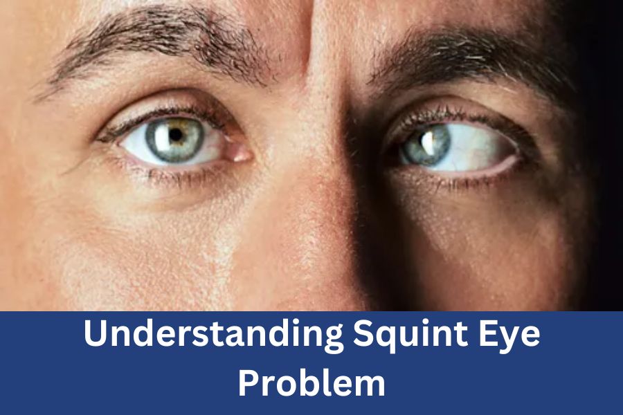 Understanding Squint Eye Problem