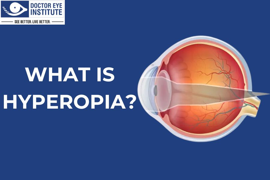 What is Hyperopia?