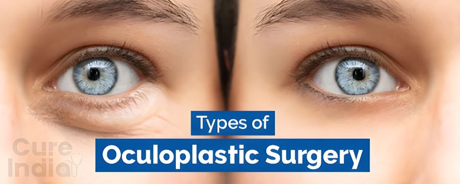 Types Of Oculoplastic Surgery